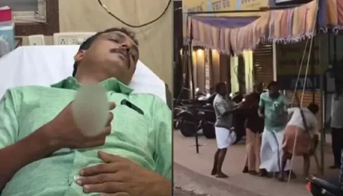 എല്ഡിഎഫ് സ്ഥാനാര്ഥിയുടെ വിരല് കടിച്ച് മുറിച്ച് യുഡിഎഫ് സ്ഥാനാര്ത്ഥിയുടെ ബന്ധു; കൈയില് ആഴത്തില് മുറിവേറ്റ സ്ഥാനാര്ത്ഥി ആശുപത്രിയില് എല്ഡിഎഫ് സ്ഥാനാര്ഥിയുടെ വിരല് കടിച്ച് മുറിച്ച് യുഡിഎഫ് സ്ഥാനാര്ത്ഥിയുടെ ബന്ധു; കൈയില് ആഴത്തില് മുറിവേറ്റ സ്ഥാനാര്ത്ഥി ആശുപത്രിയില്