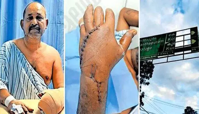 എംസി റോഡില് സ്ഥാപിച്ച കൂറ്റന് ദിശാസൂചക ഫലകത്തിന്റെ ലോഹപാളി അടര്ന്ന് വീണു; സ്കൂട്ടര് യാത്രക്കാരന്റെ കൈപ്പത്തി അറ്റു തൂങ്ങി എംസി റോഡില് സ്ഥാപിച്ച കൂറ്റന് ദിശാസൂചക ഫലകത്തിന്റെ ലോഹപാളി അടര്ന്ന് വീണു; സ്കൂട്ടര് യാത്രക്കാരന്റെ കൈപ്പത്തി അറ്റു തൂങ്ങി