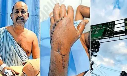 എംസി റോഡില്‍ സ്ഥാപിച്ച കൂറ്റന്‍ ദിശാസൂചക ഫലകത്തിന്റെ ലോഹപാളി അടര്‍ന്ന് വീണു; സ്‌കൂട്ടര്‍ യാത്രക്കാരന്റെ കൈപ്പത്തി അറ്റു തൂങ്ങി