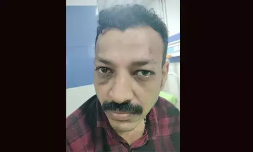 സ്‌കൂട്ടര്‍ യാത്രക്കാരായ ദമ്പതികളെ ആക്രമിച്ച കേസില്‍ യുവാവ് പിടിയില്‍