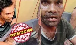 10,000 മൃതദേഹങ്ങള്‍ പോസ്റ്റ് മോര്‍ട്ടം ചെയ്തിട്ടുണ്ട്; ഇത്രയധികം മര്‍ദനമേറ്റ ശരീരം കാണുന്നത് ആദ്യം, മരിച്ചശേഷവും കൊടിയ മര്‍ദനം; കാലിന്റെ ചെറുവിരല്‍ മുതല്‍ തലയോട്ടിവരെ തകര്‍ന്നിട്ടുണ്ട്; രാംനാരായണിന്റെ ആള്‍ക്കൂട്ട മര്‍ദ്ദന കേസില്‍ നടുക്കുന്ന വെളിപ്പെടുത്തലുമായി ഡോക്ടര്‍ ഹിതേഷ് ശങ്കര്‍