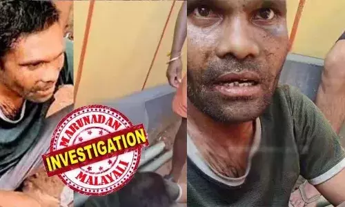 10,000 മൃതദേഹങ്ങള്‍ പോസ്റ്റ് മോര്‍ട്ടം ചെയ്തിട്ടുണ്ട്; ഇത്രയധികം മര്‍ദനമേറ്റ ശരീരം കാണുന്നത് ആദ്യം, മരിച്ചശേഷവും കൊടിയ മര്‍ദനം; കാലിന്റെ ചെറുവിരല്‍ മുതല്‍ തലയോട്ടിവരെ തകര്‍ന്നിട്ടുണ്ട്; രാംനാരായണിന്റെ ആള്‍ക്കൂട്ട മര്‍ദ്ദന കേസില്‍ നടുക്കുന്ന വെളിപ്പെടുത്തലുമായി ഡോക്ടര്‍ ഹിതേഷ് ശങ്കര്‍