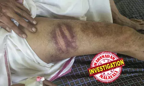 മദ്യപിച്ച് വീട്ടില്‍ പ്രശ്‌നമുണ്ടാക്കിയെന്ന് ഭാര്യ പരാതിപ്പെട്ടു;  ഓട്ടോ ഡ്രൈവര്‍ക്ക് കസ്റ്റഡിയില്‍ മര്‍ദനം; വീണതെന്ന് പൊലീസ്; ശരീരമാസകലം ലാത്തിപ്പാടുകള്‍;  കമ്മീഷണര്‍ക്ക് പരാതി നല്‍കും