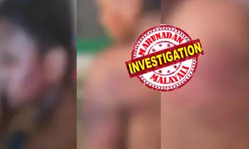 ശരീരത്തിന്റെ പല ഭാഗത്തും നല്ല ചതവ് ഉണ്ട്; മുഖത്തും കൈയിലും അടക്കം അടിച്ചുനുറുക്കിയ പാടുകൾ; ആ ഭിന്നശേഷിക്കാരന്റെ അവസ്ഥ വളരെ ദയനീയം; അധ്യാപകന്റെ കൊടുംക്രൂരതയ്ക്ക് പിന്നിലെ കാരണം കേട്ട് പോലീസിന് ഞെട്ടൽ