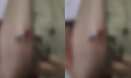 സ്വകാര്യ ട്യൂഷന്‍ സെന്ററില്‍ പ്ലസ് വണ്‍ വിദ്യാര്‍ത്ഥിക്ക് മര്‍ദ്ദനമേറ്റു; അധ്യാപകനെതിരെ പരാതി