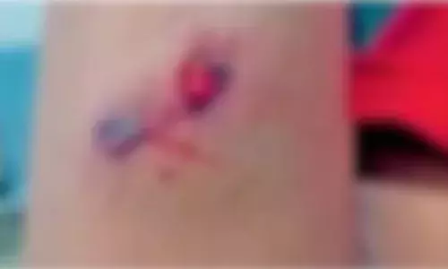 പാഠഭാഗം എഴുതിത്തീര്‍ത്തില്ലെന്നാരോപിച്ച് കൈ അടിച്ചു പൊട്ടിച്ചു; ട്യൂഷന്‍ സെന്ററില്‍ പ്ലസ് വണ്‍ വിദ്യാര്‍ത്ഥി നേരിട്ടത് ക്രൂര പീഡനം