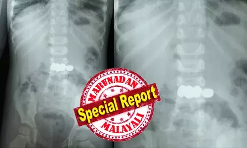 കളിക്കുന്നതിനിടെ അബദ്ധത്തിൽ വിഴുങ്ങിയത് കളിപ്പാട്ടത്തിലെ 5 ബാറ്ററികൾ; ഒട്ടും വൈകാതെ കുട്ടിയെ ആശുപത്രിയിലെത്തിച്ച് വീട്ടുകാർ; പൊട്ടിയിരുന്നെങ്കിൽ ജീവന് പോലും ഭീഷണിയായേനെ; രണ്ടു വയസുകാരന്റെ ജീവൻ രക്ഷിച്ച് ഡോക്ടർമാർ