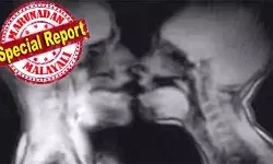 എംആര്‍ഐ മെഷീനുള്ളില്‍ കയറി ലൈംഗിക പരീക്ഷണം; ദമ്പതികളുടെ പ്രകടനം കണ്ട് അന്തംവിട്ട് ഡോക്ടര്‍മാരും ലോകവും; മൂത്രസഞ്ചി നിറഞ്ഞത് ശാസ്ത്രലോകം പഠനവിധേയമാക്കും; കൂടെയൊരു ഭീകര അപകട കഥയും