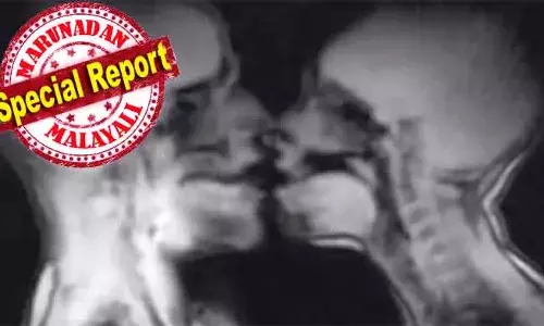 എംആര്‍ഐ മെഷീനുള്ളില്‍ കയറി ലൈംഗിക പരീക്ഷണം; ദമ്പതികളുടെ പ്രകടനം കണ്ട് അന്തംവിട്ട് ഡോക്ടര്‍മാരും ലോകവും; മൂത്രസഞ്ചി നിറഞ്ഞത് ശാസ്ത്രലോകം പഠനവിധേയമാക്കും; കൂടെയൊരു ഭീകര അപകട കഥയും