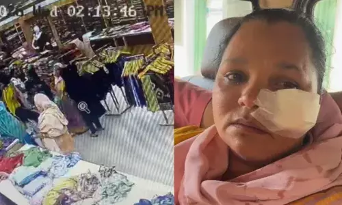 തുണിക്കടയില്‍ കയറി ജീവനക്കാരിയുടെ മുഖം കത്തികൊണ്ട് കീറി 19-കാരി; മകന്‍ സ്‌നേഹിക്കുന്ന കുട്ടിയാണ് ആക്രമിച്ചതെന്ന് യുവതി; വയനാടിനെ നടുക്കിയ ക്രൂരത