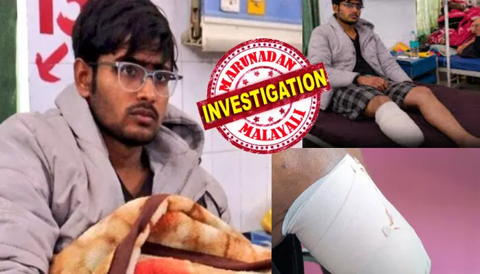 രാത്രി മുഴുവൻ പഠിച്ചിട്ട് കിടന്നുറങ്ങിയ ആ വിദ്യാർത്ഥി; രാവിലെ എഴുന്നേറ്റപ്പോൾ ഒരു കാൽ അറ്റ നിലയിൽ; അവന്റെ ഡയറിയിൽ..ഇനി ലക്ഷ്യം കാണാതെ ഞാൻ അടങ്ങില്ലെന്ന വെല്ലുവിളിയും; വിവരം അറിഞ്ഞെത്തിയ നാട്ടുകാർക്ക് പോലും ഒന്നും മനസ്സിലാകുന്നില്ല; പോലീസിന്റെ വരവിൽ ഞെട്ടിപ്പിക്കുന്ന സത്യം പുറത്ത്; തലയിൽ കൈവച്ച് വീട്ടുകാർ രാത്രി മുഴുവൻ പഠിച്ചിട്ട് കിടന്നുറങ്ങിയ ആ വിദ്യാർത്ഥി; രാവിലെ എഴുന്നേറ്റപ്പോൾ ഒരു കാൽ അറ്റ നിലയിൽ; അവന്റെ ഡയറിയിൽ..ഇനി ലക്ഷ്യം കാണാതെ ഞാൻ അടങ്ങില്ലെന്ന വെല്ലുവിളിയും; വിവരം അറിഞ്ഞെത്തിയ നാട്ടുകാർക്ക് പോലും ഒന്നും മനസ്സിലാകുന്നില്ല; പോലീസിന്റെ വരവിൽ ഞെട്ടിപ്പിക്കുന്ന സത്യം പുറത്ത്; തലയിൽ കൈവച്ച് വീട്ടുകാർ