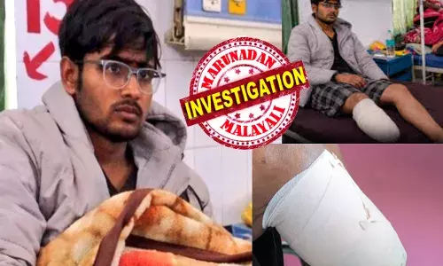 രാത്രി മുഴുവൻ പഠിച്ചിട്ട് കിടന്നുറങ്ങിയ ആ വിദ്യാർത്ഥി; രാവിലെ എഴുന്നേറ്റപ്പോൾ ഒരു കാൽ അറ്റ നിലയിൽ; അവന്റെ ഡയറിയിൽ..ഇനി ലക്ഷ്യം കാണാതെ ഞാൻ അടങ്ങില്ലെന്ന വെല്ലുവിളിയും; വിവരം അറിഞ്ഞെത്തിയ നാട്ടുകാർക്ക് പോലും ഒന്നും മനസ്സിലാകുന്നില്ല; പോലീസിന്റെ വരവിൽ ഞെട്ടിപ്പിക്കുന്ന സത്യം പുറത്ത്; തലയിൽ കൈവച്ച് വീട്ടുകാർ