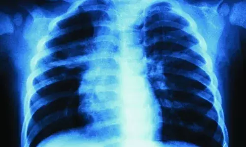 ബൈക്കില്‍ കാറിടിച്ച് പരിക്കേറ്റു;  ഇടത് നെഞ്ചില്‍ വേദനയുണ്ടെന്ന് യുവാവ്; എക്‌സ്‌റെയെടുത്തത് വലത് ഭാഗത്ത്; കുഴപ്പമൊന്നുമില്ലെന്ന് ഡോക്ടര്‍; ആലപ്പുഴ മെഡിക്കല്‍ കോളജിലും ചികിത്സാപ്പിഴവ്