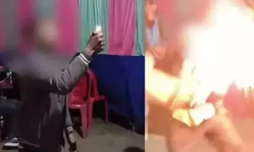 റീല്‍സ് വൈറലാകാന്‍ 14കാരന്റെ  തീക്കളി;  വായില്‍ മണ്ണെണ്ണ നിറച്ച് തീയില്‍ തുപ്പി; മുഖം പൊള്ളി നശിച്ചു; ലൈക്കുകള്‍ക്ക് വേണ്ടി ജീവിതം ഹോമിക്കണോ? സോഷ്യല്‍ മീഡിയയെ നടുക്കി ആ വീഡിയോ