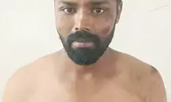 മോഷ്ടിച്ച ബൈക്കില്‍ കറങ്ങി നടക്കവെ അപകടം; പ്രതിയെ അറസ്റ്റ് ചെയ്ത് പോലിസ്