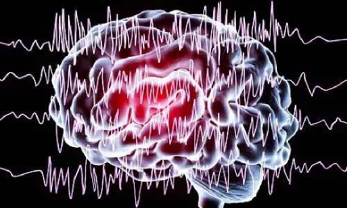 അപസ്മാര രോഗനിര്‍ണ്ണയം കൂടുതല്‍ വ്യക്തമായി: ചികിത്സയോട് പ്രതികരിക്കാത്ത അപസ്മാര രോഗികള്‍ക്ക് ഒരു പുതിയ പ്രതീക്ഷ