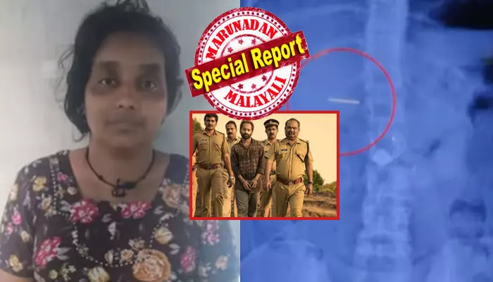 ഒന്നും അറിയാത്ത പാവം പെണ്ണായി സമീന ആശുപത്രി വരാന്തയിലെത്തിയത് ഒരൊറ്റ ലക്ഷ്യത്തിന്; ഒരു കുഞ്ഞിന്റെ കഴുത്തിൽ തങ്കമാല തിളങ്ങുന്നത് കണ്ടതും അവളുടെ സ്വഭാവം തന്നെ ആകെ മാറി; ലാളനയുടെ മുഖമണിഞ്ഞ് കള്ളത്തരം; പൊക്കുമെന്ന് കണ്ടതും അതെടുത്ത് വിഴുങ്ങി ധൈര്യം; ഇതോടെ പോലീസിനും തലവേദന; ഇത് തൊണ്ടിമുതലും ദൃക്സാക്ഷിയും പോലെ മറ്റൊരു കഥ ഒന്നും അറിയാത്ത പാവം പെണ്ണായി സമീന ആശുപത്രി വരാന്തയിലെത്തിയത് ഒരൊറ്റ ലക്ഷ്യത്തിന്; ഒരു കുഞ്ഞിന്റെ കഴുത്തിൽ തങ്കമാല തിളങ്ങുന്നത് കണ്ടതും അവളുടെ സ്വഭാവം തന്നെ ആകെ മാറി; ലാളനയുടെ മുഖമണിഞ്ഞ് കള്ളത്തരം; പൊക്കുമെന്ന് കണ്ടതും അതെടുത്ത് വിഴുങ്ങി ധൈര്യം; ഇതോടെ പോലീസിനും തലവേദന; ഇത് തൊണ്ടിമുതലും ദൃക്സാക്ഷിയും പോലെ മറ്റൊരു കഥ