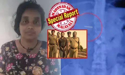 ഒന്നും അറിയാത്ത പാവം പെണ്ണായി സമീന ആശുപത്രി വരാന്തയിലെത്തിയത് ഒരൊറ്റ ലക്ഷ്യത്തിന്; ഒരു കുഞ്ഞിന്റെ കഴുത്തിൽ തങ്കമാല തിളങ്ങുന്നത് കണ്ടതും അവളുടെ സ്വഭാവം തന്നെ ആകെ മാറി; ലാളനയുടെ മുഖമണിഞ്ഞ് കള്ളത്തരം; പൊക്കുമെന്ന് കണ്ടതും അതെടുത്ത് വിഴുങ്ങി ധൈര്യം; ഇതോടെ പോലീസിനും തലവേദന; ഇത് തൊണ്ടിമുതലും ദൃക്സാക്ഷിയും പോലെ മറ്റൊരു കഥ