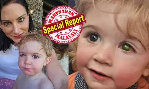 കളി കഴിഞ്ഞാൽ വിരൽ കൊണ്ട് കണ്ണ് തിരുമ്മാൻ തുടങ്ങും; കുറച്ച് ദിവസം കഴിഞ്ഞതും കുഞ്ഞിന്റെ അമ്മ ഇതെല്ലാം ശ്രദ്ധിക്കാൻ തുടങ്ങി; പെട്ടെന്ന് ഒരു വശം മുഴുവൻ പച്ച നിറത്തിലായി; പിന്നിലെ കാരണം കണ്ടുപിടിക്കാൻ പറ്റാതെ ഡോക്ടർമാരും വലഞ്ഞു; വില്ലനായത് ആ അജ്ഞാതന്റെ ചുംബനമോ?