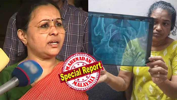 വേദന അത് അനുഭവിക്കുന്നവര്ക്ക് മാത്രമേ മനസ്സിലാകൂ, വീഴ്ച വ്യക്തികളുടെ ഭാഗത്തുനിന്ന്; പ്രാഥമിക റിപ്പോര്ട്ടിന്റെ അടിസ്ഥാനത്തില് വിദഗ്ധ അന്വേഷണത്തിന് സമിതിയെ നിയോഗിക്കും; ഒരു മെഡിക്കല് ബോര്ഡ് രൂപീകരിക്കും; ശസ്ത്രക്രിയ ഉള്പ്പെടെയുള്ള തുടര്നടപടികള്ക്ക് സര്ക്കാര് മേല്നോട്ടം വഹിക്കുമെന്ന് മന്ത്രി വീണ ജോര്ജ്ജ് വേദന അത് അനുഭവിക്കുന്നവര്ക്ക് മാത്രമേ മനസ്സിലാകൂ, വീഴ്ച വ്യക്തികളുടെ ഭാഗത്തുനിന്ന്; പ്രാഥമിക റിപ്പോര്ട്ടിന്റെ അടിസ്ഥാനത്തില് വിദഗ്ധ അന്വേഷണത്തിന് സമിതിയെ നിയോഗിക്കും; ഒരു മെഡിക്കല് ബോര്ഡ് രൂപീകരിക്കും; ശസ്ത്രക്രിയ ഉള്പ്പെടെയുള്ള തുടര്നടപടികള്ക്ക് സര്ക്കാര് മേല്നോട്ടം വഹിക്കുമെന്ന് മന്ത്രി വീണ ജോര്ജ്ജ്