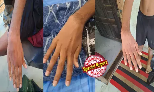 കോന്നി മെഡിക്കല്‍ കോളേജില്‍ കൈവിട്ട ചികിത്സ; 14 കാരന്റെ ഒടിഞ്ഞ കൈക്ക് രണ്ടരമാസം ചികിത്സ, ഒടുവില്‍ കൈ വളഞ്ഞു; ചികിത്സാ പിഴവ് ആരോപണവുമായി കുടുംബം; ചികിത്സിച്ചില്ലെങ്കിലും കുട്ടിയുടെ കൈ തനിയെ ശരിയാകുമായിരുന്നു എന്ന് സൂപ്രണ്ട്; ആശുപത്രി നന്നാവാന്‍ കാത്തിരിക്കണമെന്നും വിചിത്ര ന്യായം; ഉപരോധം അടക്കം ജനരോഷം ഇരമ്പുന്നു