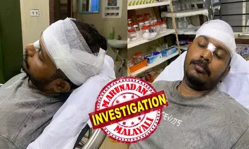 പതിവുപോലെ ചായയും ചെറുകടികളും കഴിച്ച് ബില്ലുകൊടുക്കാതെ പുറത്തേക്കിറങ്ങി; ഭക്ഷണം കഴിച്ച പണം ചോദിച്ചപ്പോൾ കടയുടമയുടെ തല അടിച്ചുതകർത്തു; ജീവനക്കാരനും ക്രൂരമർദനം; തൃക്കാക്കരയിലെ ഗുണ്ടാ സ്റ്റൈൽ അഴിഞ്ഞാട്ടത്തിൽ ഒരാൾ പിടിയിൽ