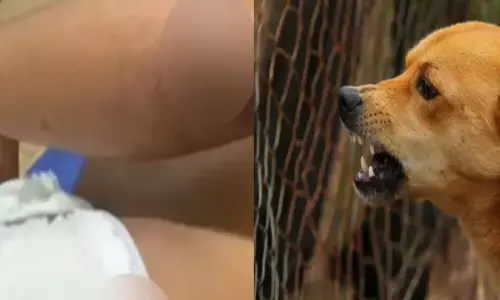 കുറെ നേരം വിളിച്ചുനോക്കി; എന്നിട്ടും ഒരൊറ്റ മനുഷ്യൻ പുറത്തുവന്നില്ല; രണ്ടുംകല്പിച്ച് യുവാവ് ഗേറ്റ് തുറന്ന് അകത്ത് കയറിയതും ചാടിക്കടിച്ച് വളർത്തുനായ; കൈമുട്ടിലും വയറ്റിലും ആഴത്തിൽ മുറിവ്