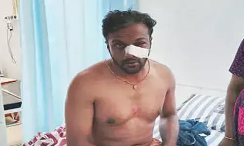 സിങ്കുകണ്ടത്ത് കാട്ടാന യുവാവിനെ തുമ്പിക്കൈക്ക് അടിച്ചു വീഴ്ത്തി;  നെഞ്ചിനും കാലുകള്‍ക്കും പരിക്കേറ്റ യുവാവ് ആശുപത്രിയില്‍