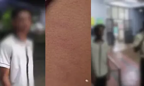 കോഴിക്കോട് എട്ടാം ക്ലാസ് വിദ്യാര്‍ത്ഥിക്ക് സീനിയര്‍ വിദ്യാര്‍ത്ഥികളുടെ ക്രൂരമര്‍ദനം;  15 വിദ്യാര്‍ത്ഥികള്‍ ചേര്‍ന്ന് മര്‍ദിച്ചു