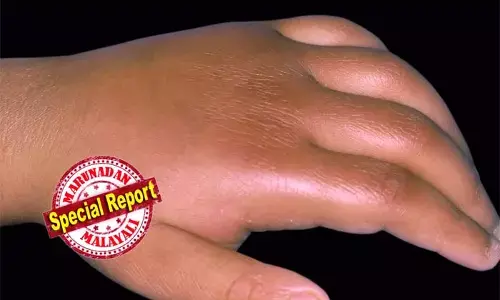 കാരണങ്ങളൊന്നുമില്ലാതെ വരുന്ന പനിയോടെ തുടക്കം; പനി മൂര്‍ച്ഛിച്ച് ഹൃദയധമനികളുടെ പ്രവര്‍ത്തനം നിലച്ച് പൊട്ടിപ്പോകുന്ന അവസ്ഥ; കട്ടപ്പനയില്‍ അപൂര്‍വ്വ രോഗം ബാധിച്ചത് കുരുന്നിന്; അതിവേഗ ചികിത്സയില്‍ ഒന്നര വയസ്സുകാരിക്ക് രോഗശാന്തി; എന്താണ് കട്ടപ്പനയില്‍ റിപ്പോര്‍ട്ട് ചെയ്ത കവാസാക്കി