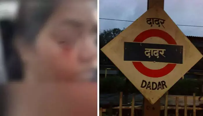 മുംബൈ ലോക്കല് ട്രെയിനില് യാത്രക്കിടെ യുവതിക്ക് നേരെ കല്ലേറ്; കണ്ണിന് ഗുരുതര പരിക്ക് മുംബൈ ലോക്കല് ട്രെയിനില് യാത്രക്കിടെ യുവതിക്ക് നേരെ കല്ലേറ്; കണ്ണിന് ഗുരുതര പരിക്ക്