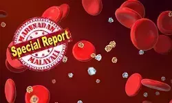 കണ്ണിന്റെ വെള്ളയില് ഉണ്ടാകുന്ന ചില അടയാളങ്ങള് സൂചിപ്പിക്കുന്നത് ഒരുപക്ഷെ മരണകാരണം വരെയാകാവുന്ന രോഗങ്ങളുടെ വരവിനെ; നിങ്ങളുടെ ഭക്ഷണത്തില് ഒളിച്ചിരിക്കുന്ന ചില പ്രോട്ടീനുകള് പ്രായാധിക്യം പെട്ടെന്ന് പ്രകടമാക്കിയേക്കാം; ചിലപ്പോള് കാന്സറിനു വരെ കാരണമായേക്കാം; ഭക്ഷണക്രമം മാറ്റി ഇതിനെ വലിയൊരു പരിധിവരെ തടയാം കണ്ണിന്റെ വെള്ളയില് ഉണ്ടാകുന്ന ചില അടയാളങ്ങള് സൂചിപ്പിക്കുന്നത് ഒരുപക്ഷെ മരണകാരണം വരെയാകാവുന്ന രോഗങ്ങളുടെ വരവിനെ; നിങ്ങളുടെ ഭക്ഷണത്തില് ഒളിച്ചിരിക്കുന്ന ചില പ്രോട്ടീനുകള് പ്രായാധിക്യം പെട്ടെന്ന് പ്രകടമാക്കിയേക്കാം; ചിലപ്പോള് കാന്സറിനു വരെ കാരണമായേക്കാം; ഭക്ഷണക്രമം മാറ്റി ഇതിനെ വലിയൊരു പരിധിവരെ തടയാം