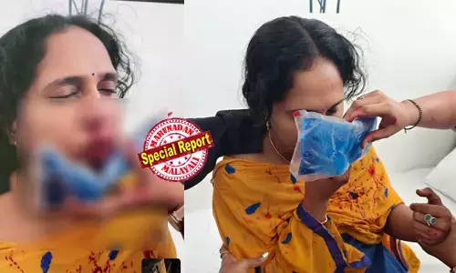 ക്ലാസിനിടെ കംപ്യൂട്ടര് ഗെയിം വിലക്കി; മാലിദ്വീപിലെ സ്കൂളില് മലയാളി അധ്യാപികയുടെ മൂക്കിടിച്ച് തകര്ത്ത് വിദ്യാര്ത്ഥി! ക്രൂരമായ മര്ദനത്തില് രക്തം വാര്ന്ന് അധ്യാപിക നിലത്തുവീണു; സഹപ്രവര്ത്തകര് തടയാന് നോക്കിയിട്ടും അക്രമം തുടര്ന്നു; മൂക്കിനും തലയ്ക്കും ഗുരുതര പരിക്ക്; അച്ചടക്കം പഠിപ്പിച്ചാല് മര്ദനം വിധി; അധ്യാപകരുടെ സുരക്ഷയില് കടുത്ത ആശങ്ക! ക്ലാസിനിടെ കംപ്യൂട്ടര് ഗെയിം വിലക്കി; മാലിദ്വീപിലെ സ്കൂളില് മലയാളി അധ്യാപികയുടെ മൂക്കിടിച്ച് തകര്ത്ത് വിദ്യാര്ത്ഥി! ക്രൂരമായ മര്ദനത്തില് രക്തം വാര്ന്ന് അധ്യാപിക നിലത്തുവീണു; സഹപ്രവര്ത്തകര് തടയാന് നോക്കിയിട്ടും അക്രമം തുടര്ന്നു; മൂക്കിനും തലയ്ക്കും ഗുരുതര പരിക്ക്; അച്ചടക്കം പഠിപ്പിച്ചാല് മര്ദനം വിധി; അധ്യാപകരുടെ സുരക്ഷയില് കടുത്ത ആശങ്ക!