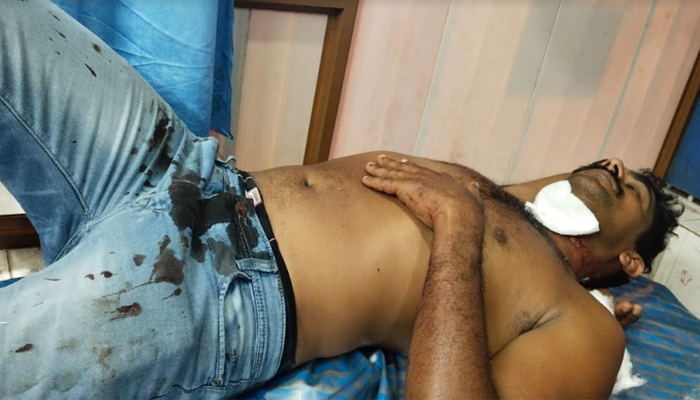 പൊട്ടിവീണ വൈദ്യുതി കമ്പി ചുറ്റിയത് ബൈക്ക് യാത്രികന്റെ കഴുത്തില്‍; ബൈക്കില്‍ നിന്ന് വീണ യുവാവ് രക്ഷപ്പെട്ടത് തലനാരിഴയ്ക്ക്