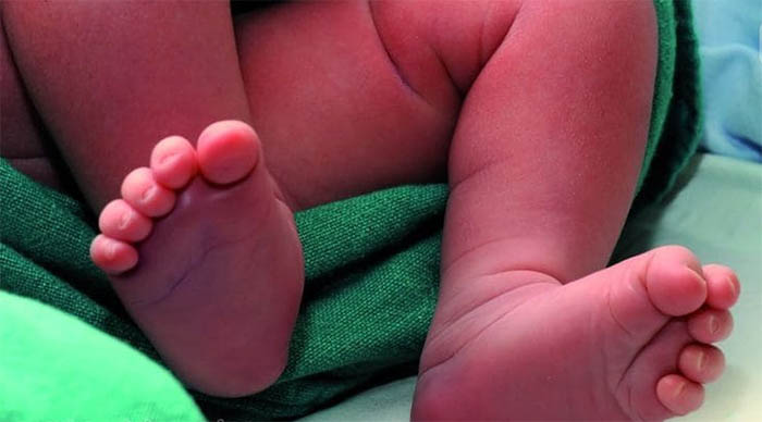 റമ്പൂട്ടാന്‍ കുരു തൊണ്ടയില്‍ കുടുങ്ങി എട്ടുമാസം പ്രായമുള്ള കുഞ്ഞ് മരിച്ചു